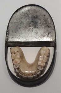 Dentures with Waterloo Teeth - Military Museum, Dresden, Germany